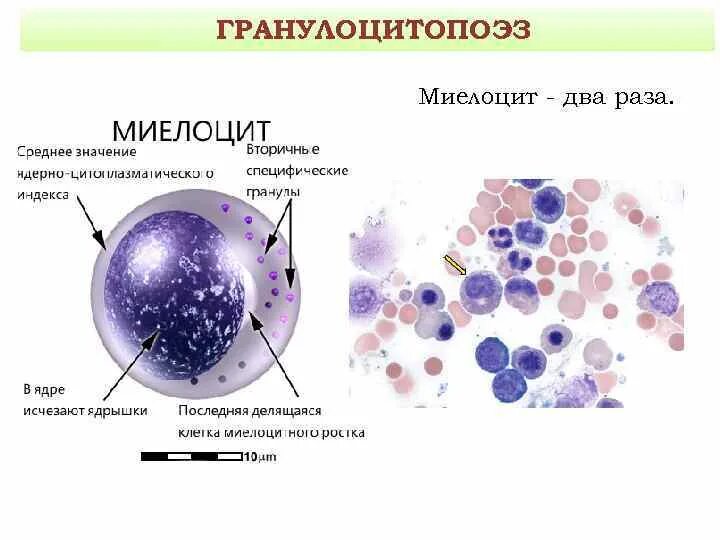 Клетки с дегенеративными изменениями в цитологии. Клетки с дегенеративными изменениями в цитологии