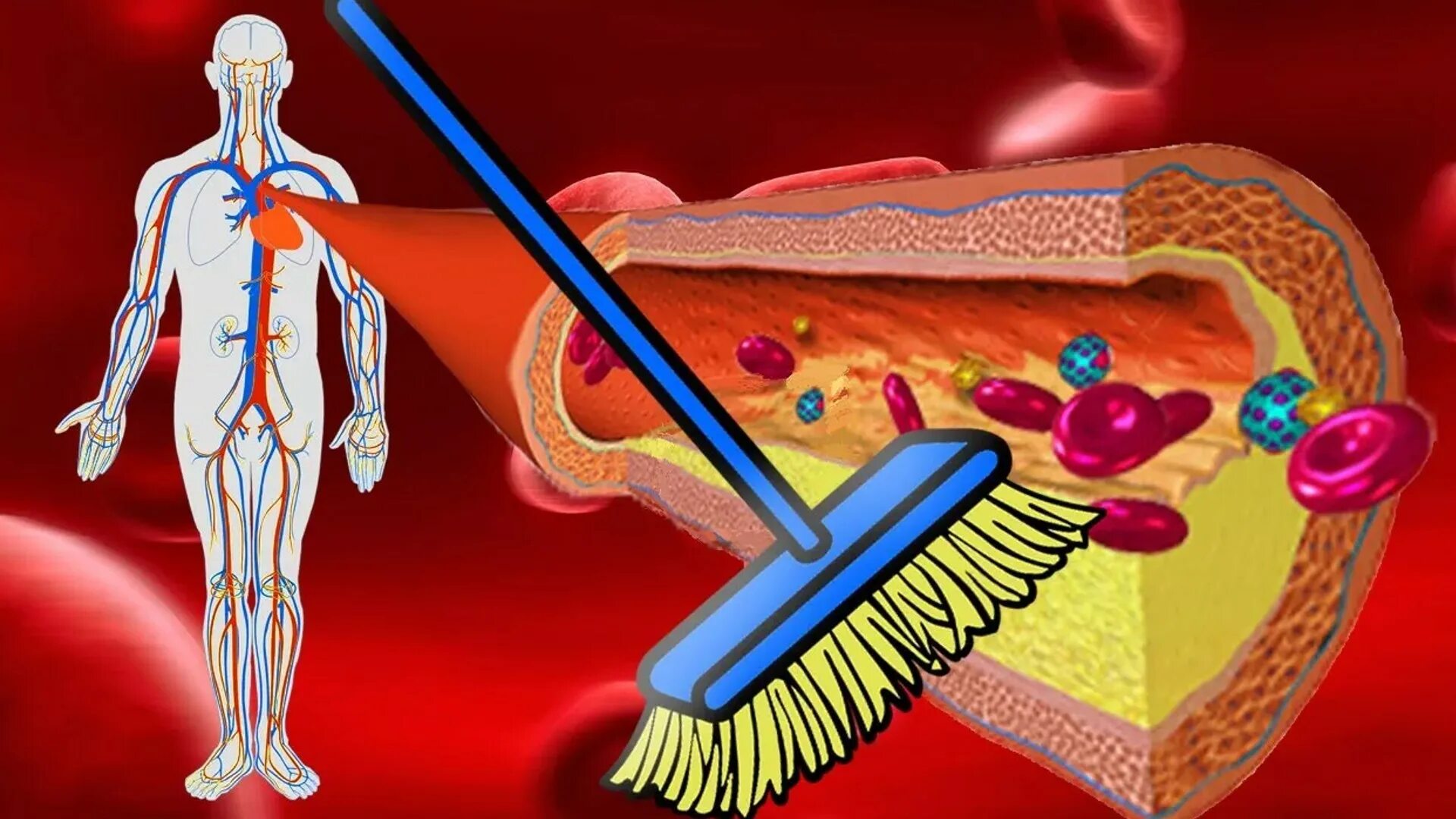 Как организм человека очищается. Загрязненные кровеносные сосуды. Очистить кровеносные сосуды.