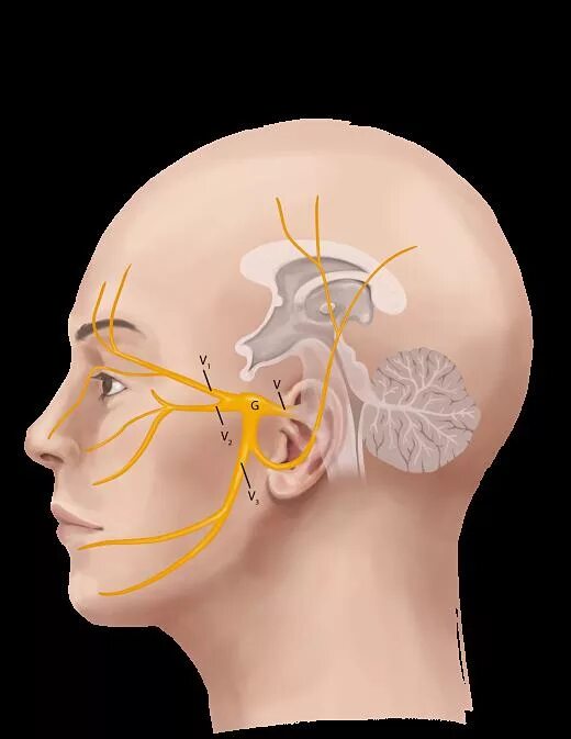 Затылочный и тройничный нерв. Невралгия тройничного нерва. Затылочный нерв и тройничный нерв. Воспаление тройничного нерва в голове. Невропатия затылочного