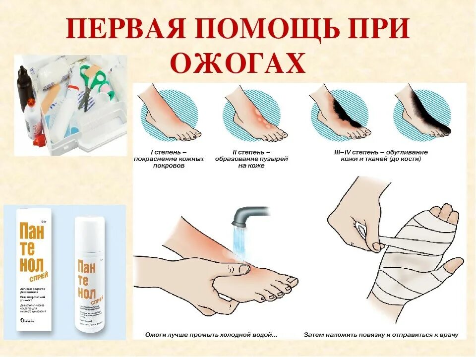 порядок оказания первой помощи при термических ожогах второй степени. оказание первой помощи при ожогах кратко. оказание первой помощи при термических ожогах. оказание 1 помощи при термических ожогах. алгоритм оказания помощи при термических ожогах.