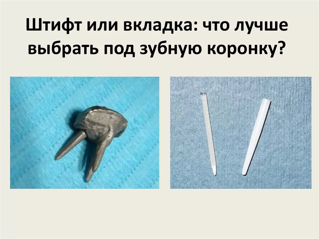 культевая вкладка со штифтом. культевая штифтовая коронка. поставить коронку на штифт. имплант абатмент коронка. матчпост стекловолоконный штифт.