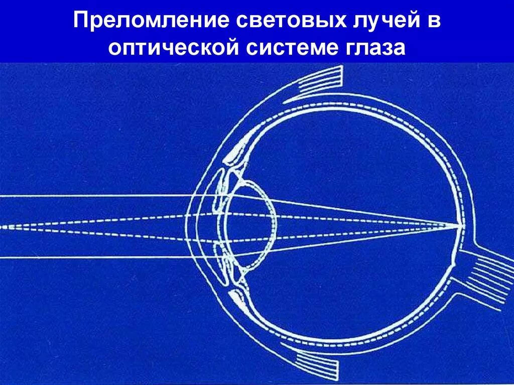 3 оптическая система глаза. Оптическая система глаза. Ход лучей в оптической системе глаза. Преломление лучей в оптической системе глаза. Что преломляет световые лучи в глазу.