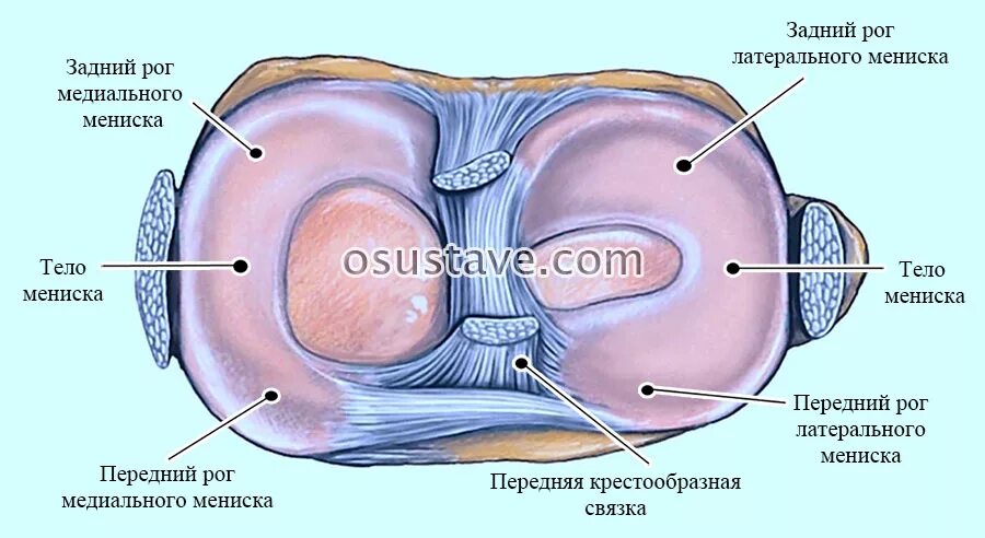 Передний рог коленного сустава. Разрыв заднего рога медиального мениска 3. Передний Рог медиального мениска. Передний Рог латерального мениска мениска. Повреждение переднего рога латерального мениска.