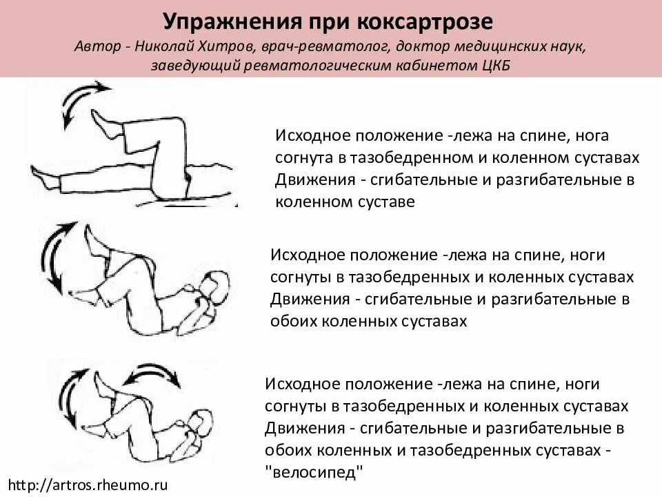 Лфк при артрозе тазобедренного сустава 2 3. Гимнастика для тазобедренного сустава при коксартрозе 2. лфк при коксартрозе 1 степени. лфк при коксартрозе 2-3 степени. упражнения лфк для тазобедренных суставов при коксартрозе.