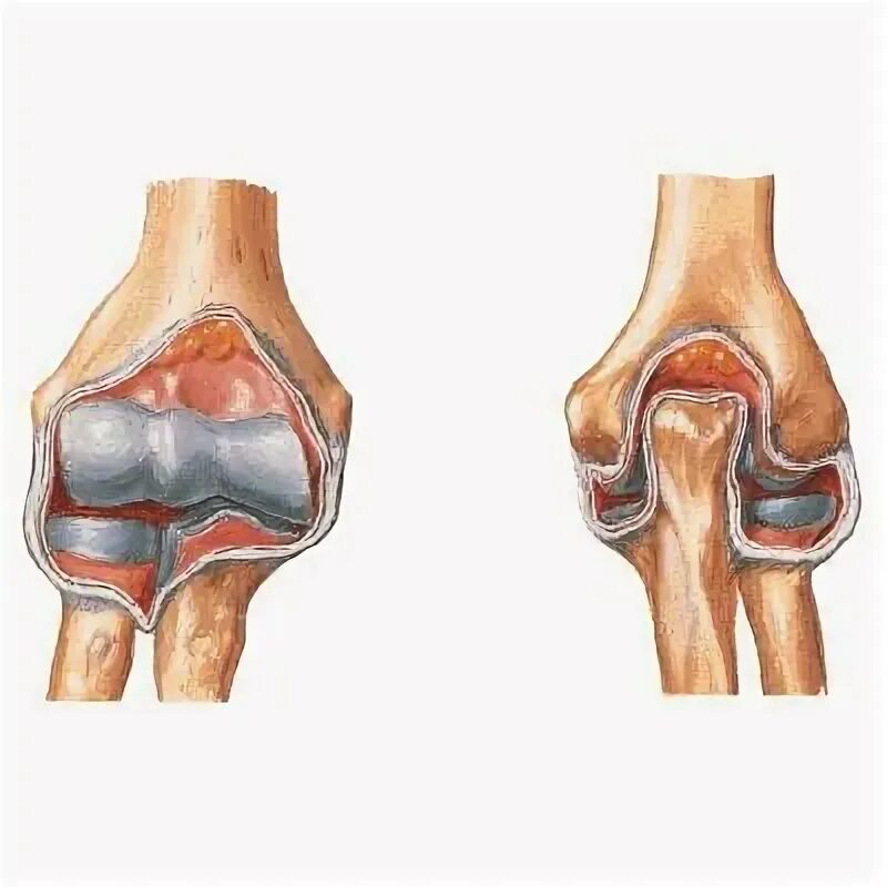 Как выглядит локоть человека Ulna Изображения: просматривайте стоковые фотографии, векторные изображения и ви