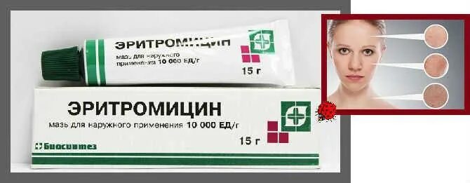 Эритромицин мазь для чего применяется взрослым. Глазная мазь от прыщей эритромицин. эритромициновая мазь 1%. эритромициновая мазь акне. эритромицин мазь биосинтез.