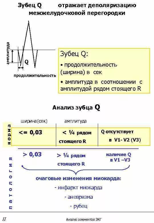 Изменение зубца q. Зубец q в норме. Зубец q на ЭКГ В норме. Амплитуда зубца q в норме составляет:. МЖП зубец q.