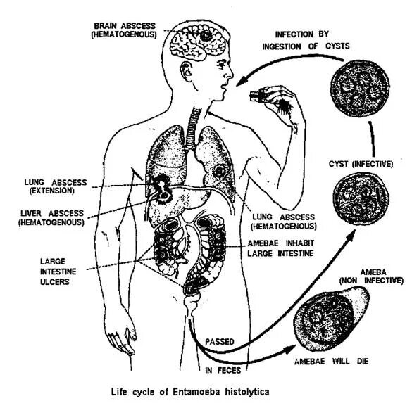 Стадия амебы поражающая толстый кишечник человека. Entamoeba histolytica жизненный цикл. Амебиаз пути заражения. Entamoeba histolytica патогенез. Амебиаз цикл развития в человеке.