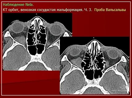 Кт орбит