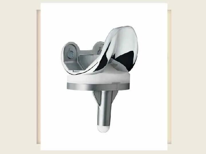 Американский эндопротез коленного сустава зиммер. Smith nephew эндопротез коленного сустава. Aesculap columbus эндопротез коленного сустава. Эндопротез stryker triathlon. Эндопротез тазобедренного сустава smith nephew.