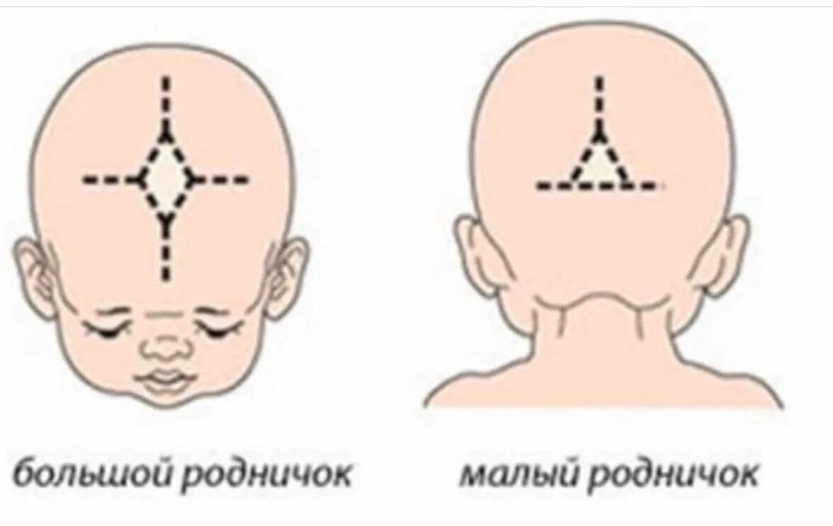 Сколько родничков у ребенка. Передний Родничок черепа новорожденного. Большой Родничок и малый Родничок у новорожденного. Родничок у новорожденных передний задний. Незакрытые роднички у новорожденных.