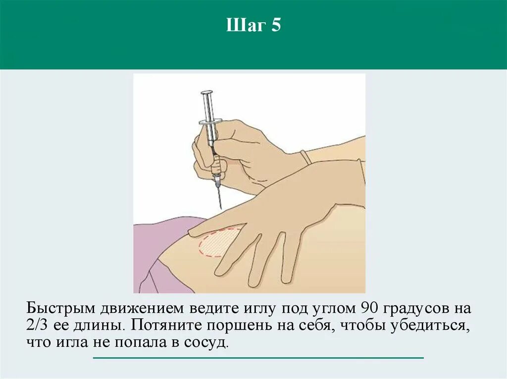 Подкожные инъекции техника выполнения. Алгоритм инъекций подкожно внутримышечно внутрикожно. Алгоритм выполнения подкожной инъекции алгоритм. Введение иглы при внутримышечной инъекции. Игла для внутримышечных инъекций вводится.