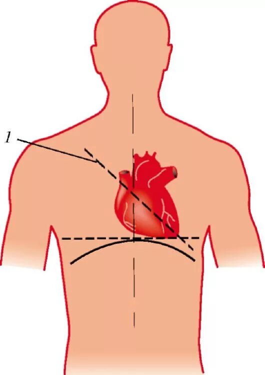Дом где находится сердце. Где находится сердце у человека. Где расположено сердце у человека за грудиной. Где находится сердце в груди человека. Что находится в левой грудине.