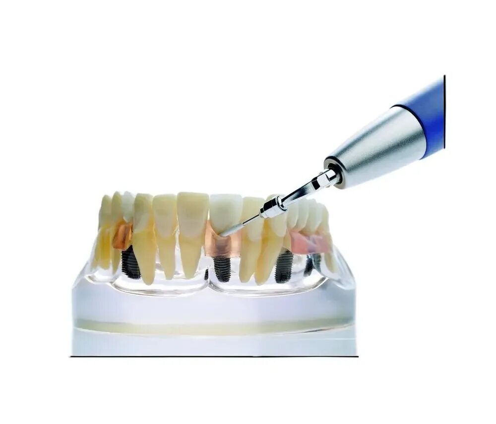 Как называется инструмент для чистки зубов ультразвуком. Насадка Pi ems. Насадка Pi для очистки имплантов. Ems ультразвуковые насадки для имплантов.