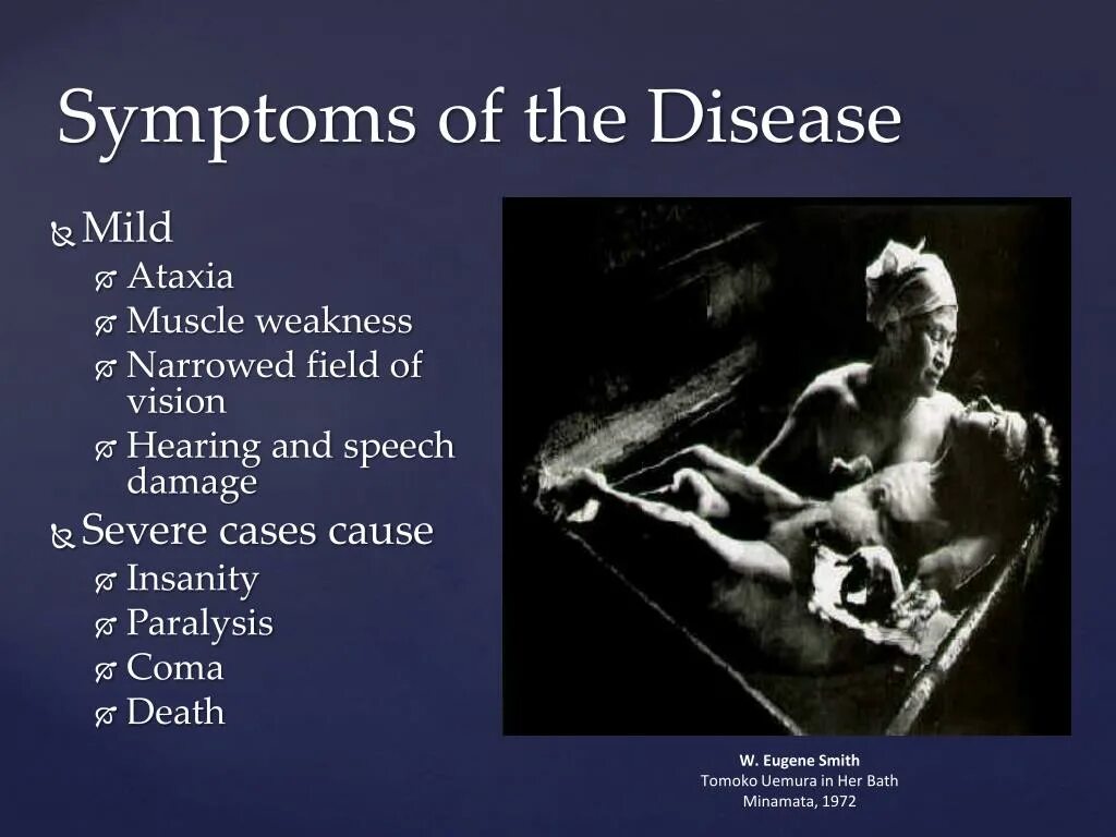 томоко уэмура в ванне. томоко уемура минамата. риоко уэмура. томоко уемура в ванной. томока уэмура в ванне исторический снимок.