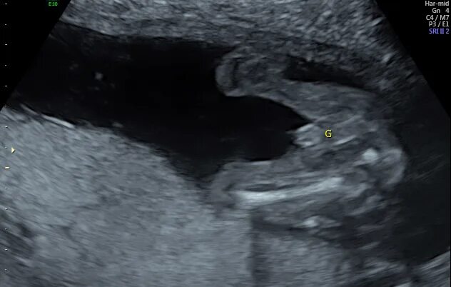 28 Yusra ideas ultrasound, ultrasound sonography, sonography
