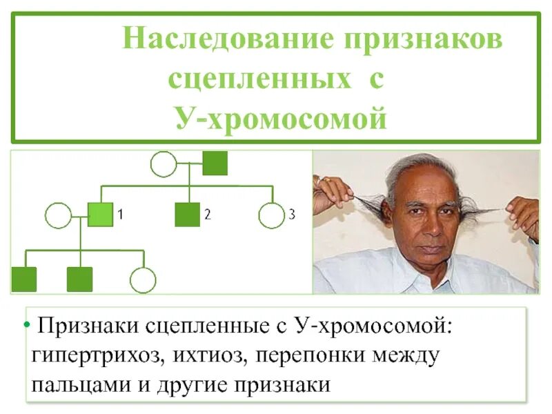 Гипертрихоз наследуется как признак. Признаки наследования, сцепленного с y-хромосомой. признаки y сцепленного типа наследования. признаки сцепленные с у хромосомой. сцепленное с у хромосомой наследование.