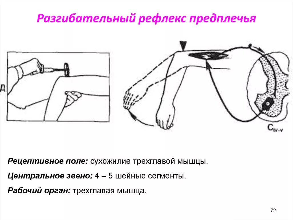 Рефлексы верхних конечностей. Рефлекторная дуга трехглавой мышцы плеча. Разгибательный рефлекс предплечья схема рефлекторной дуги. Рефлекторная дуга локтевого рефлекса схема. Сгибательный рефлекс предплечья физиология.