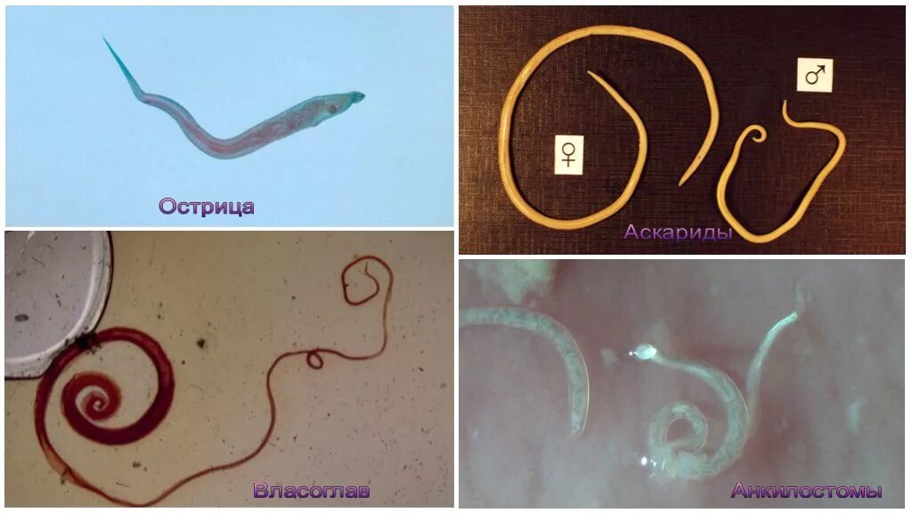 Острицы глисты гельминты. Личинки глистов энтеробиоз. Аскариды, острицы, трихинелла, фитонематоды. Острицы лямблии аскариды.