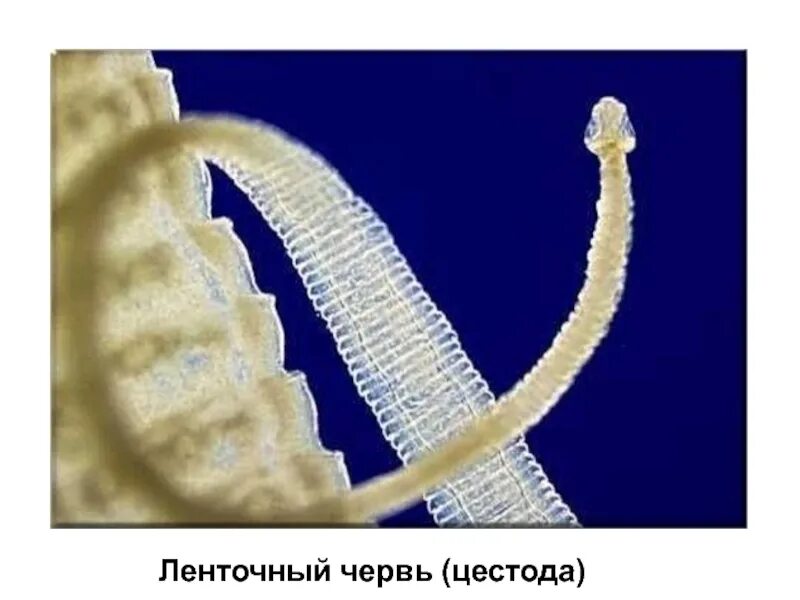 Ленточный червь бычий цепень. Ленточные черви (цестоды). Ленточный гельминт глистов. Ленточный гельминт глистов. Огуречный цепень дипилидиоз у кошек.