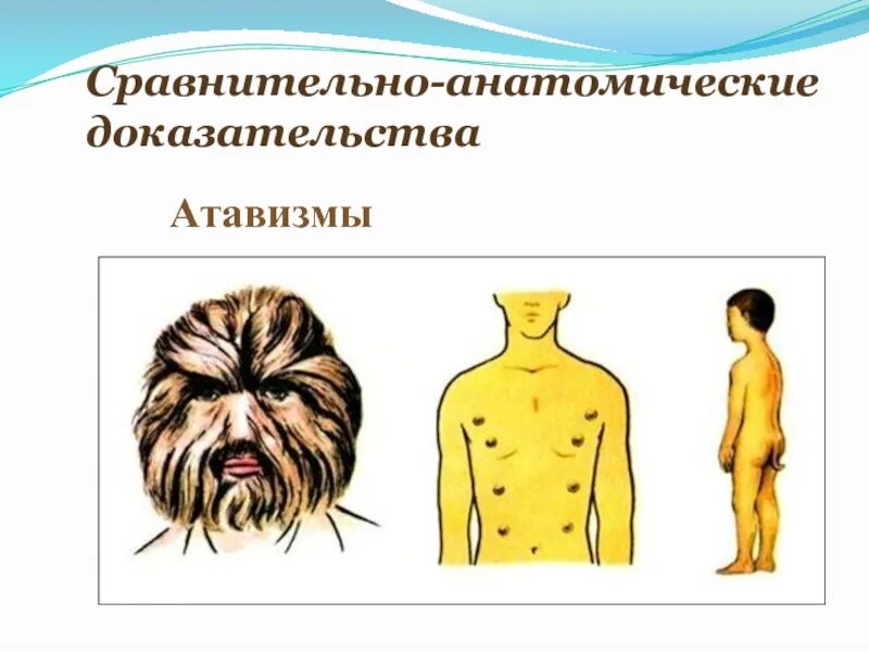 Атавизмы и рудименты человека примеры. Сравнительно-анатомические. сравнительно анатомические доказательства рудименты и атавизмы. сравнительно-анатомические доказательства происхождения человека.