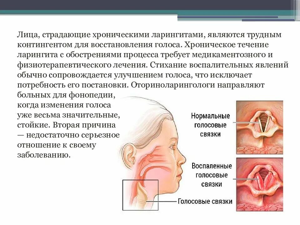 Как восстановить голосовые связки. Хронический гипертрофический ларингит. Причины острого и хронического ларингита. Хронический ларингит причины.