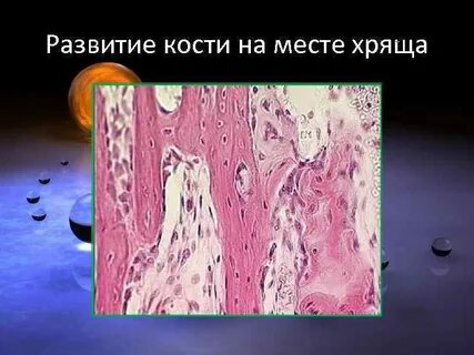Образования хрящей