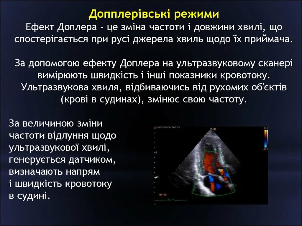 Что определяет доплер. Допплеровских режимах ультразвукового исследования. Допплеровские методы исследования. Допплеровский метод УЗИ. Допплеровское исследование принцип.