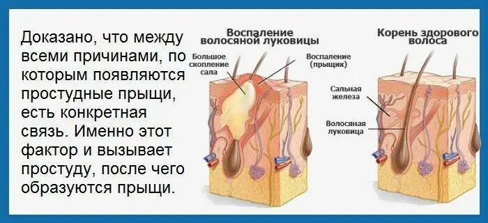 Синяки на теле без ушибов. Причины возникновения целлюлита у женщин. Почему вылез. Почему вылез. Почему вылез.