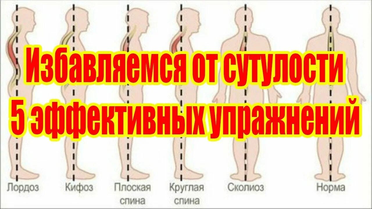 Психосоматика сутулость у женщин. Шея вытянута вперед. Нагрузка на шею при работе с телефоном. Психосоматика сутулость у женщин. Нагрузка на шею при наклоне головы.