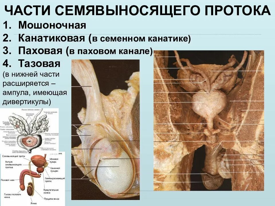 Семенной канатик анатомия. Части семявыносящего протока. Семявыносящий проток анатомия части. Семенной канатик и семявыносящий проток.