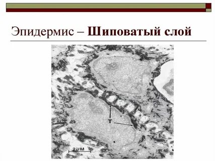 Шиповатый слой