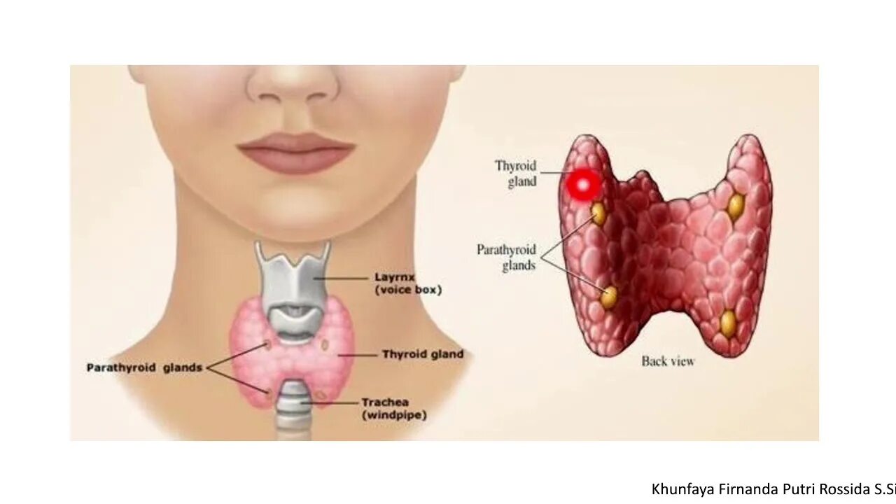 Thyroid s