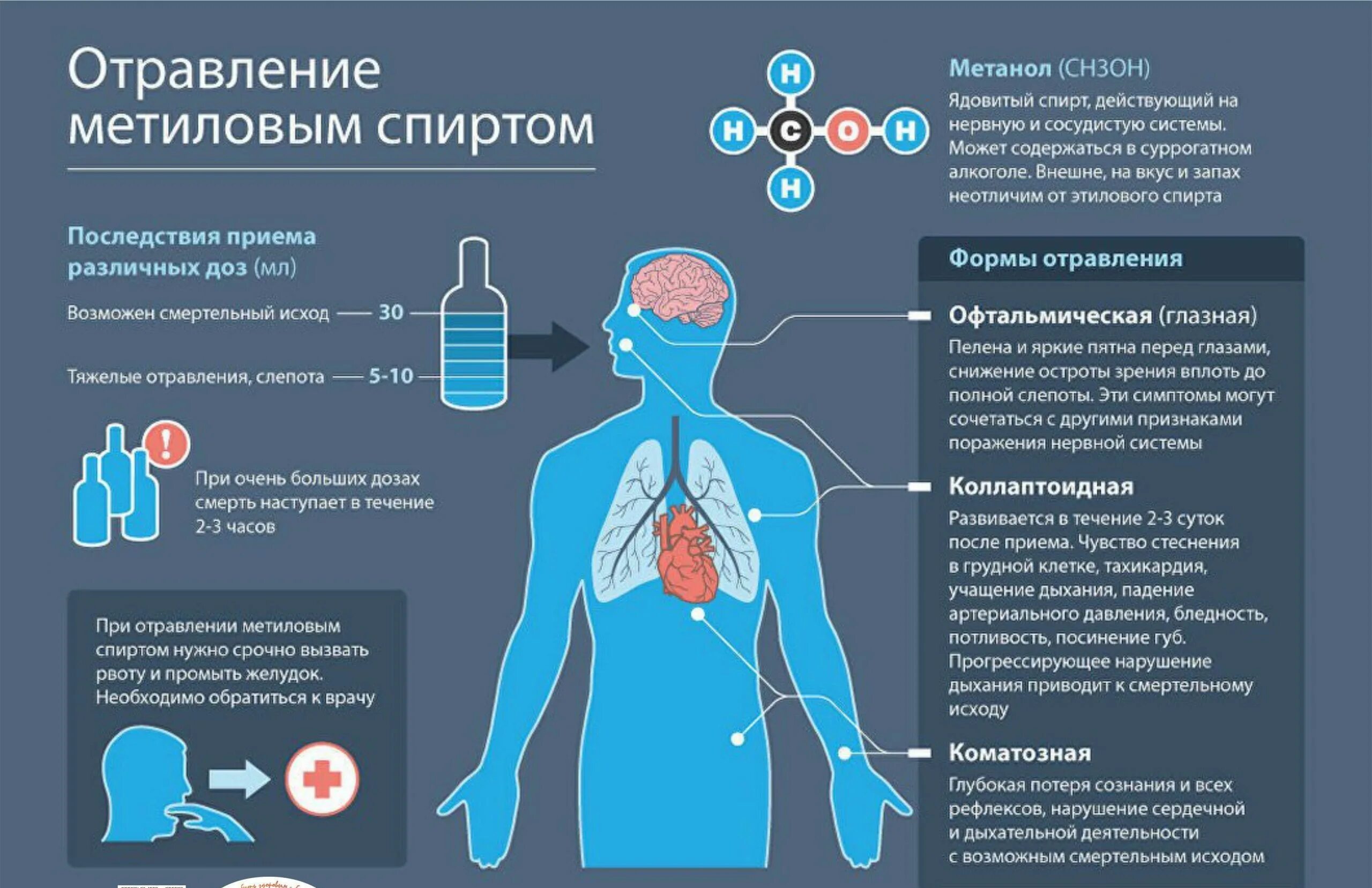 Симптомы отравления метиловым спирто. Что нужно пить при рвоте