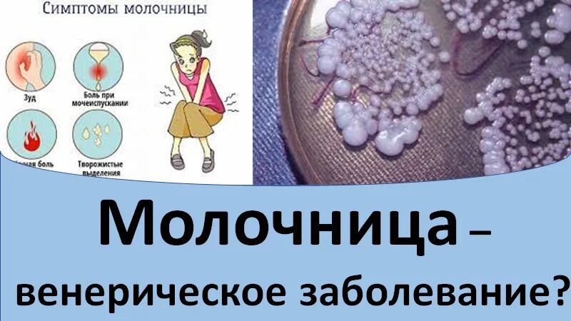 Заболевание молочница. Молочница это венерическое заболевание. Молочница от смазки