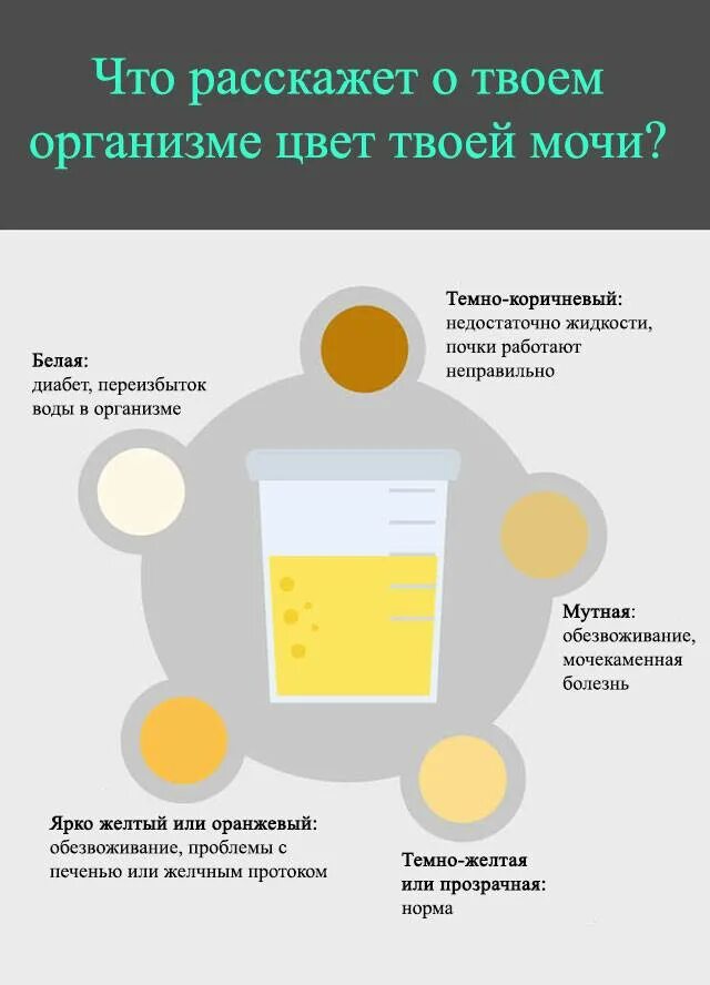 Темная моча по утрам. Цвет мочи. Изменение цвета мочи. Мояа темножелтого цвета. Моча тёмнгжёллого цвета.