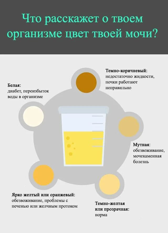 Не отходит моча у мужчины. Цвет мочи. Изменение цвета мочи. Мояа темножелтого цвета. Моча тёмнгжёллого цвета.