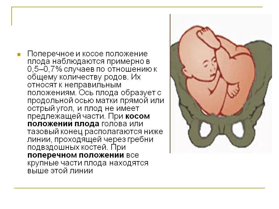 Положение плода в животе. Косое положение плода при беременности. 32 Неделя беременности поперечное положение плода. Продольное поперечное косое положение плода. Продольное расположение плода при беременности 30 недель.