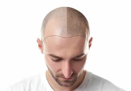 Head hair