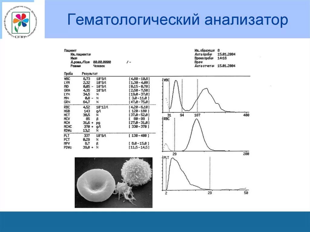 5 diff анализ. Принцип гематологических анализаторов. гистограмма гематологического анализатора. распечатка с гематологического анализатора. структурная схема гематологического анализатора.
