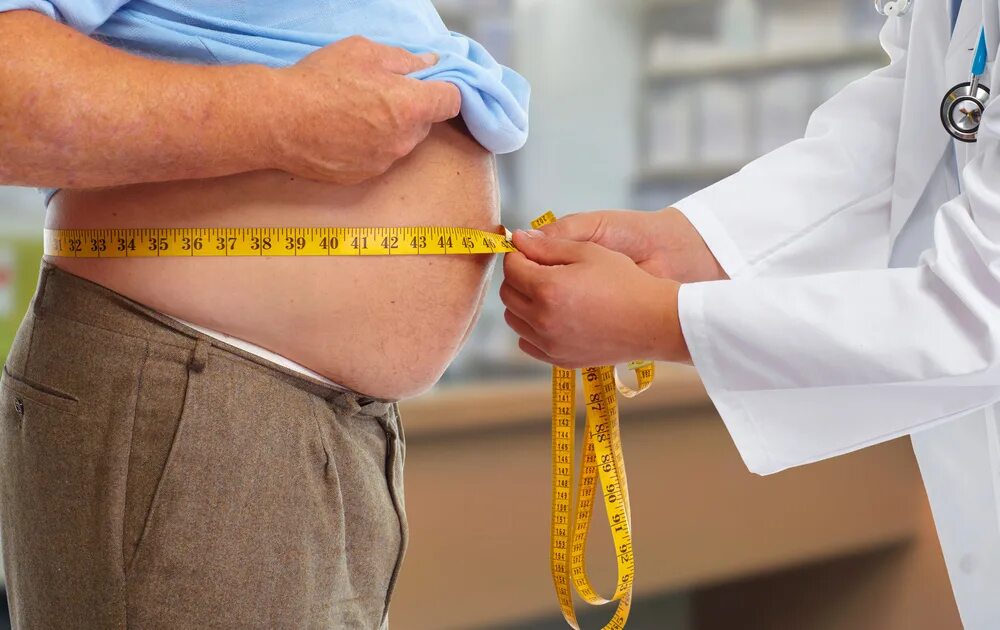Ожирение окружность талии. Ожирение. Висцеральное ожирение. Абдоминальное ожирение.