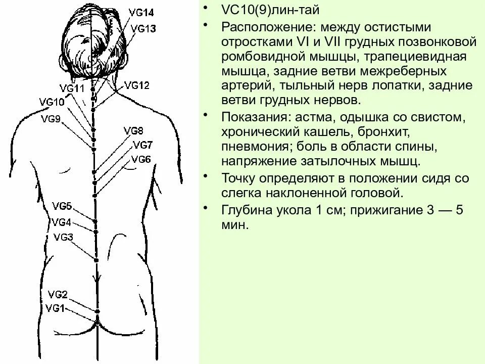 Меридианы указывают направление. Заднесрединный Меридиан точки. Заднесрединный и переднесрединный меридианы. Переднесрединный Меридиан точки и показания. Заднесрединный Меридиан Ду.