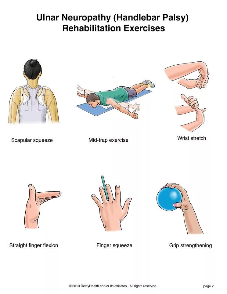 Неврит лучевого нерва ЛФК. Туннельный синдром локтевого нерва. При поражении локтевого нерва. Невропатия локтевого нерва лечебная физкультура. Упражнения при нейропатии