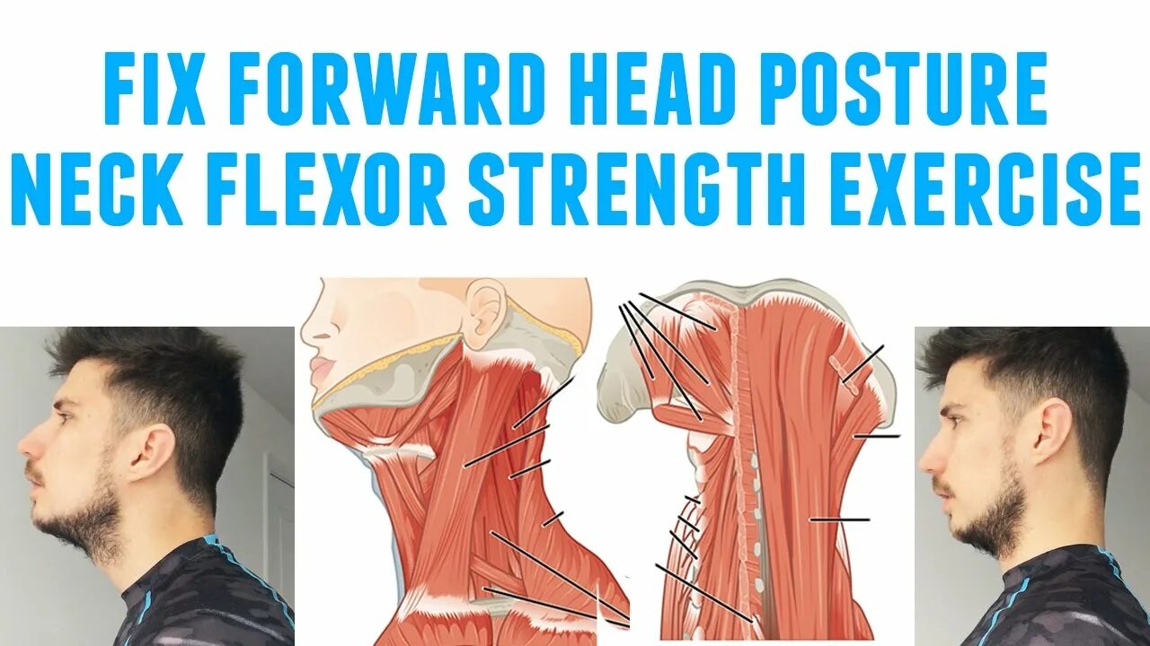Fixing head. Forward head posture. forward фикс. neck flexor. постура шея с7.