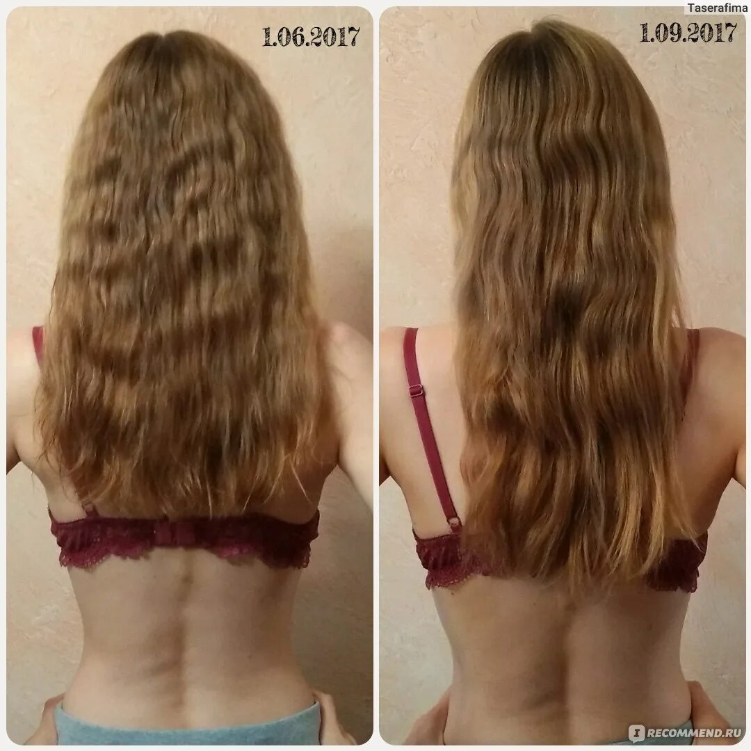 Сколько сантиметров отрастает за месяц. Отращивание волос. Отрастила волосы до и после. Рост волос до и после. Отращивание волос за год.
