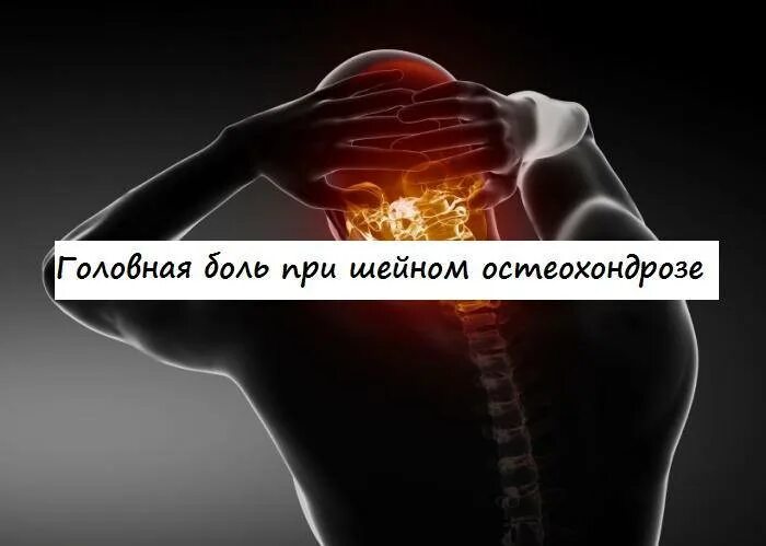 Осложнения шейного остеохондроза. Характер головной боли при остеохондрозе. Головная боль от остеохондроза. Головные боли при шейном остеохон. Головная боль при шейном остеохондрозе.