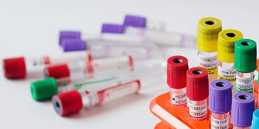 Наборы на исследования гастрина. Набор реагентов ифа бест. Bio tec ифа. Ифа диагностический препарат. Анализ набор 3.