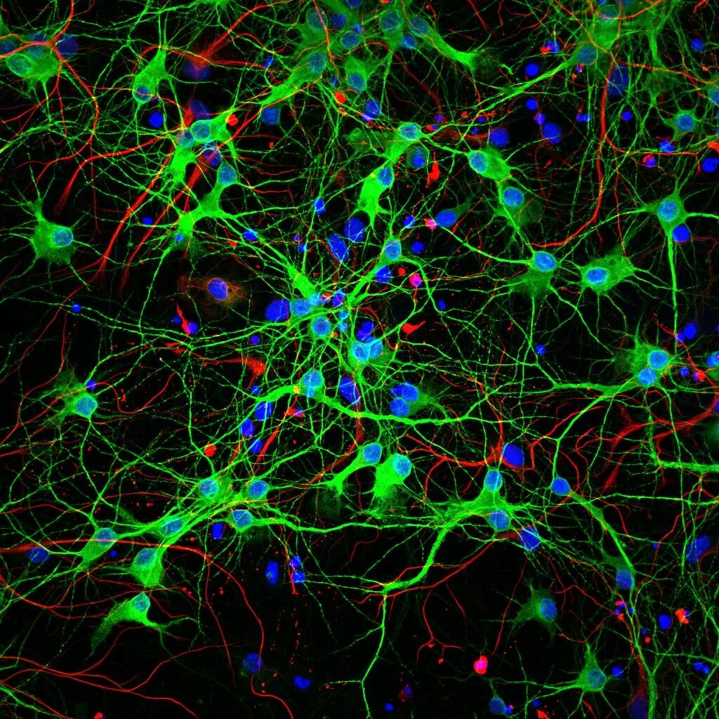 Нейросеть коры головного мозга. Искусственная нейронная сеть. Нейронные нити. Нейронная сетка.