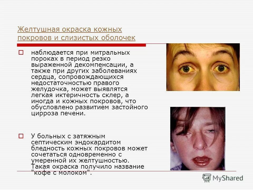 Инфекции кожных покровов и слизистых. Анаэробные гетеротрофные одноклеточные прокариоты. Рожистое воспаление характеризуется. Инфекции наружных покровов примеры заболеваний. Бактериальные инфекции наружных покровов пути передачи.