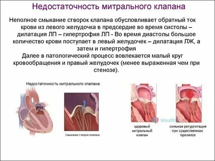 Недостаточность мк 1
